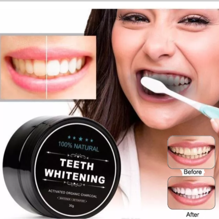 WhiteCarbon Pro –Blanqueamiento Suave y Efectivo sin Dañar el Esmalte