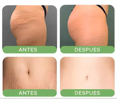 PastelCream - Crema Antiestrías con Efecto Regenerador e Hidratante