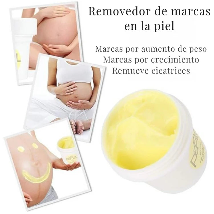 PastelCream - Crema Antiestrías con Efecto Regenerador e Hidratante