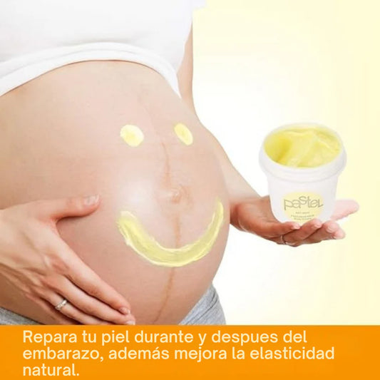 PastelCream - Crema Antiestrías con Efecto Regenerador e Hidratante